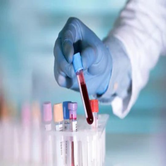 hands-lab-technician-tube-blood-260nw-441264445222